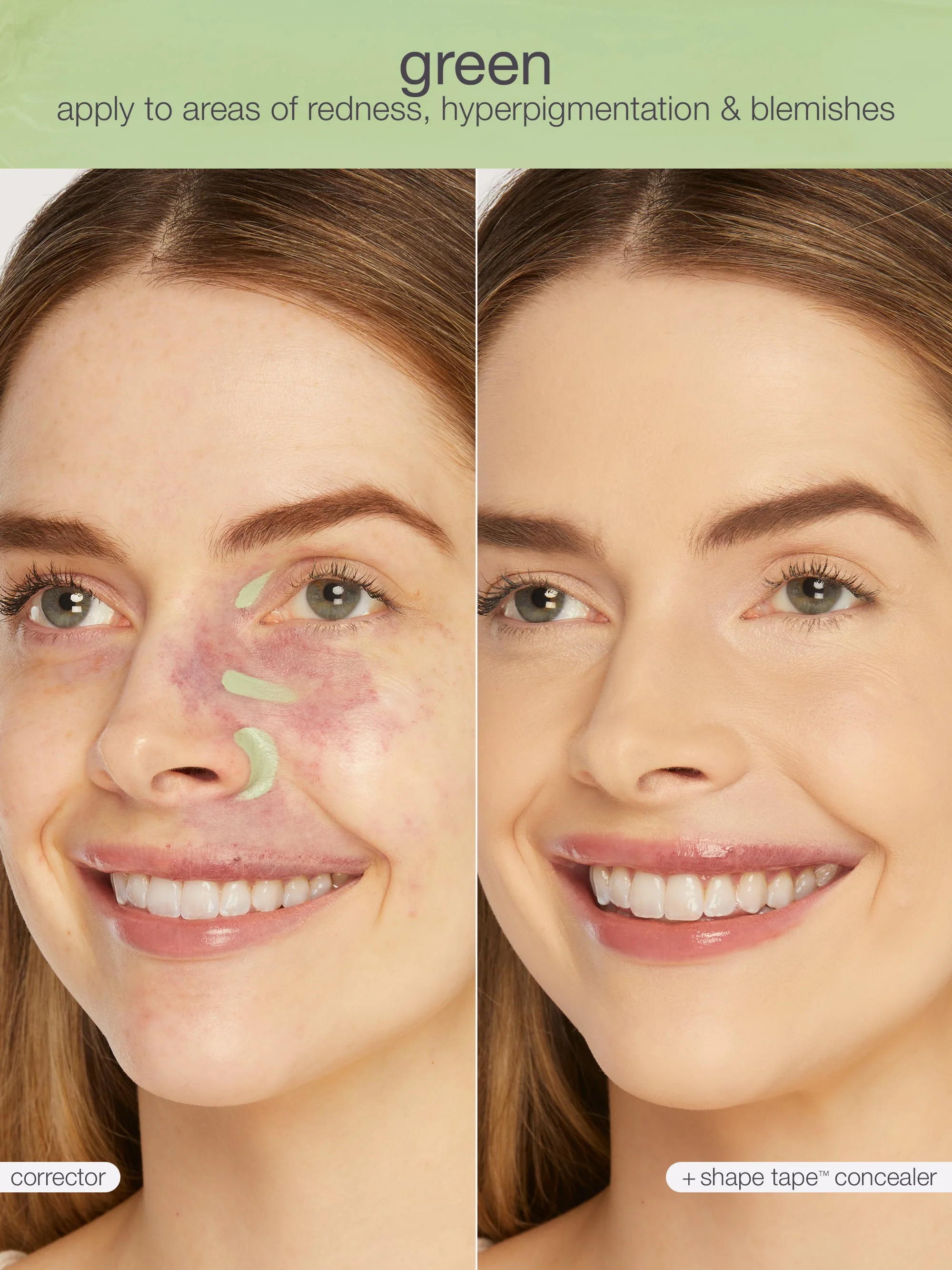 shape tape™ corrector - Image 22