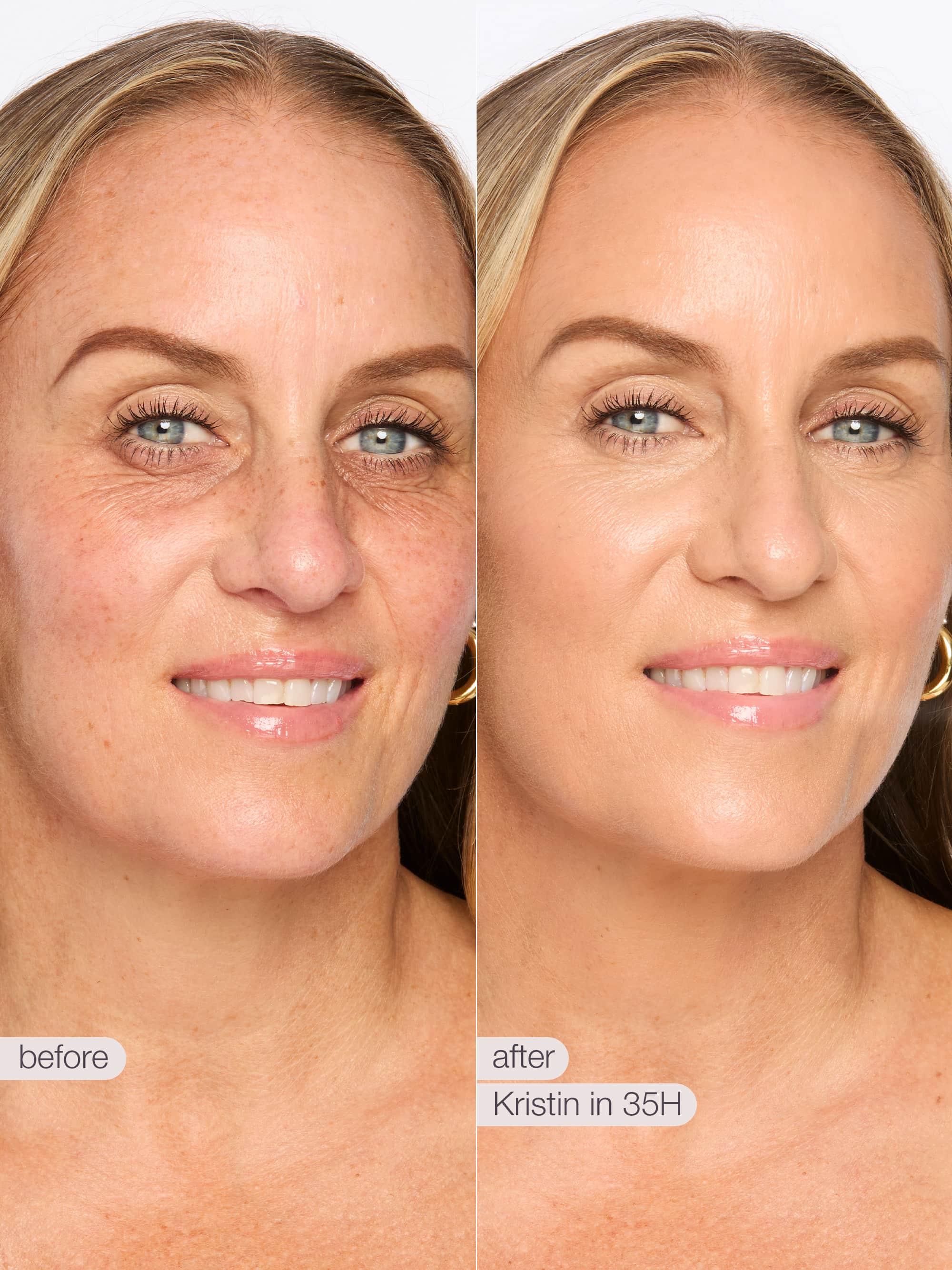 travel-size shape tape™ radiant concealer - Image 136
